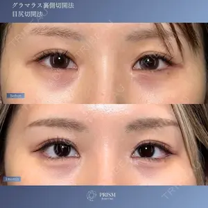 PRISM Beauty Clinic 新宿院 畑山 知輝医師の症例