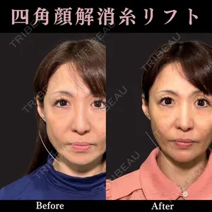 PRISM Beauty Clinic 新宿院 畑山 知輝医師の症例