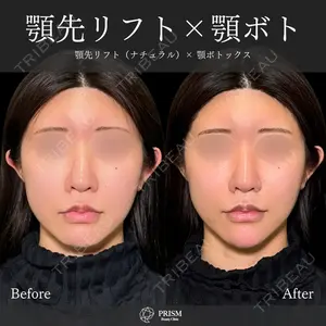 PRISM Beauty Clinic 新宿院 畑山 知輝医師の症例