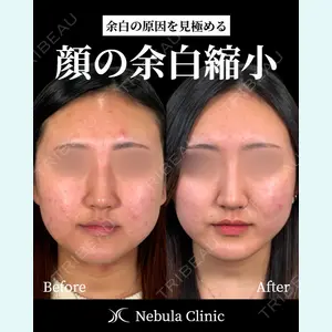 愛知春日井美容外科ネビュラクリニック 都築 諒医師の症例