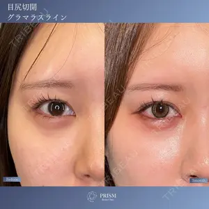PRISM Beauty Clinic 新宿院 畑山 知輝医師の症例