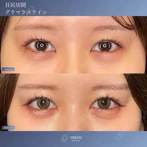 PRISM Beauty Clinic 新宿院 畑山 知輝医師の症例