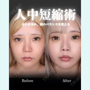 小倉美容外科/美容皮膚科 ビラビューティークリニック 大村 亞蘭医師の症例