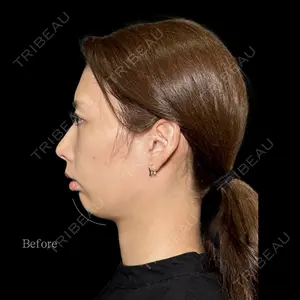 PRISM Beauty Clinic 新宿院 畑山 知輝医師の症例