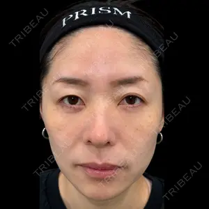 PRISM Beauty Clinic 新宿院 畑山 知輝医師の症例
