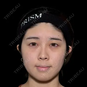 PRISM Beauty Clinic 新宿院 畑山 知輝医師の症例