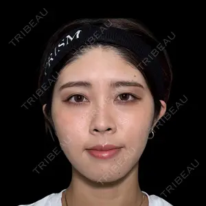 PRISM Beauty Clinic 新宿院 畑山 知輝医師の症例