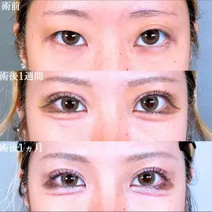 アリエル美容クリニック 水戸院 天白 典秀医師の症例