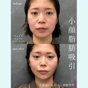 RIVER CLINIC（リバークリニック）大阪院 木家 佑理子医師の症例