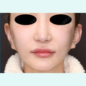症例