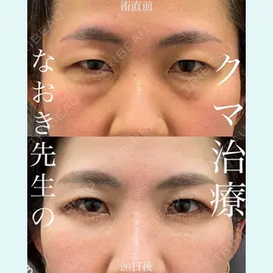 EMMO FACE CLINIC 大宮院 廣松 直樹医師の症例