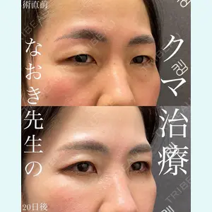 EMMO FACE CLINIC 大宮院 廣松 直樹医師の症例