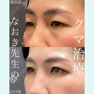 EMMO FACE CLINIC 大宮院 廣松 直樹医師の症例