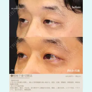 聖心美容クリニック 福岡院 權藤 理絵医師の症例