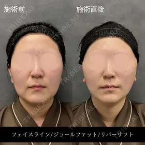 RIVER CLINIC（リバークリニック）大阪院の症例