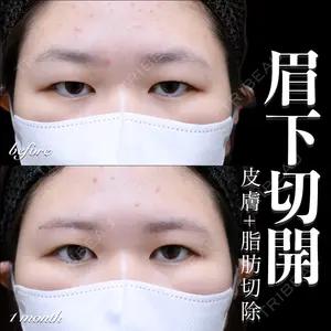 EMMO FACE CLINIC 大宮院 百瀬 直也医師の症例
