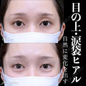 EMMO FACE CLINIC 大宮院 百瀬 直也医師の症例