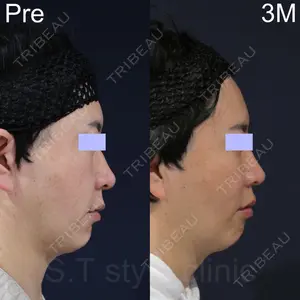 S.T styleクリニック 徳田 真紀子医師の症例