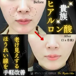 症例