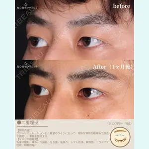 症例