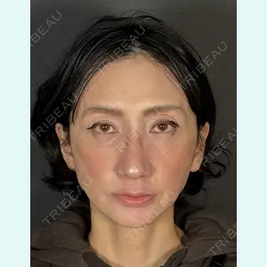 症例