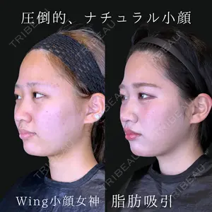Wing clinic 豊中駅前院 速水 翼医師の症例