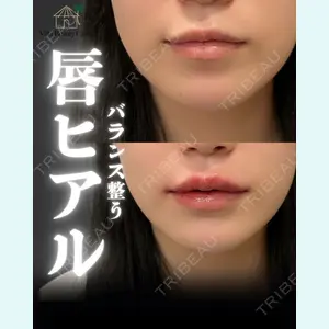 小倉美容外科/美容皮膚科 ビラビューティークリニック 大村 亞蘭医師の症例