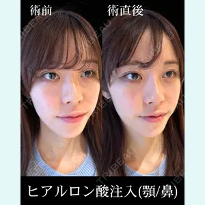 HAAB×DREAM BEAUTY CLINIC 東京本院 佐野 圭医師の症例