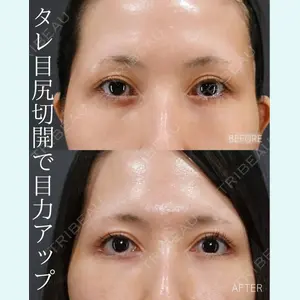 症例