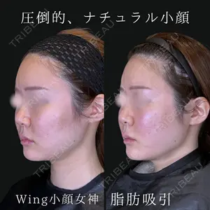 Wing clinic 豊中駅前院 速水 翼医師の症例