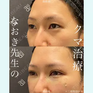 EMMO FACE CLINIC 大宮院 廣松 直樹医師の症例