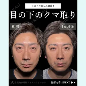 札幌美容外科ネビュラクリニック 横田 開医師の症例