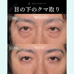 札幌美容外科ネビュラクリニック 横田 開医師の症例