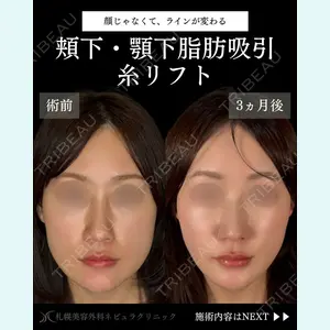 札幌美容外科ネビュラクリニック 横田 開医師の症例