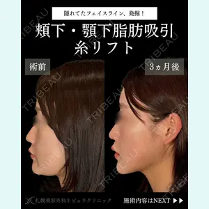 札幌美容外科ネビュラクリニック 横田 開医師の症例