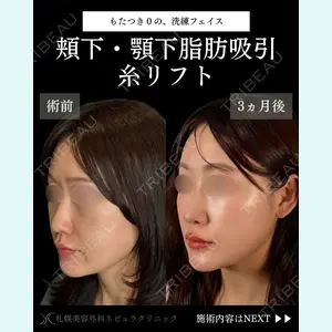 札幌美容外科ネビュラクリニック 横田 開医師の症例