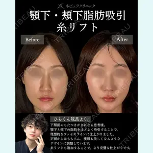札幌美容外科ネビュラクリニック 横田 開医師の症例