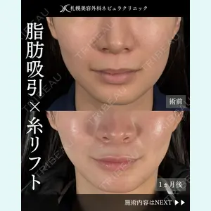 札幌美容外科ネビュラクリニック 横田 開医師の症例