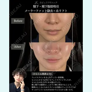 札幌美容外科ネビュラクリニック 横田 開医師の症例