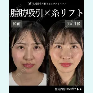 札幌美容外科ネビュラクリニック 横田 開医師の症例