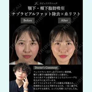 札幌美容外科ネビュラクリニック 横田 開医師の症例