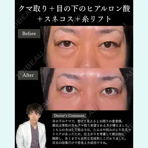 札幌美容外科ネビュラクリニック 横田 開医師の症例