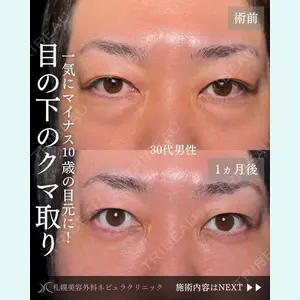 札幌美容外科ネビュラクリニック 横田 開医師の症例