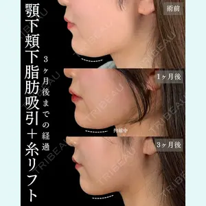 札幌美容外科ネビュラクリニック 横田 開医師の症例