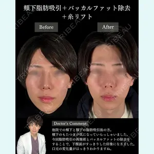 札幌美容外科ネビュラクリニック 横田 開医師の症例