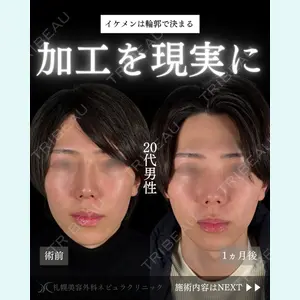 札幌美容外科ネビュラクリニック 横田 開医師の症例