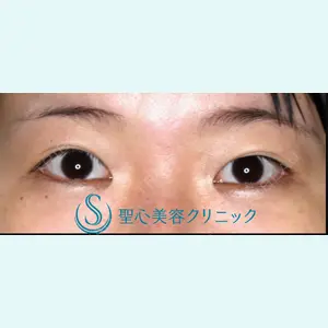 聖心美容クリニック 大阪院 大井 弘一医師の症例