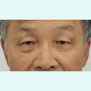 症例