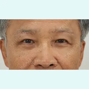 症例