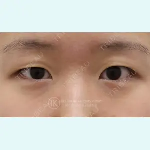 症例